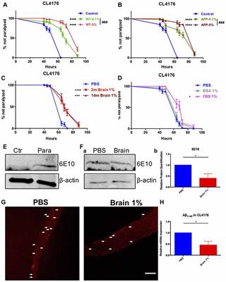 The Aβ Containing Brain Extracts Having Different Effects in Alzheimer’s Disease Transgenic Caenorhabditis elegans and Mice